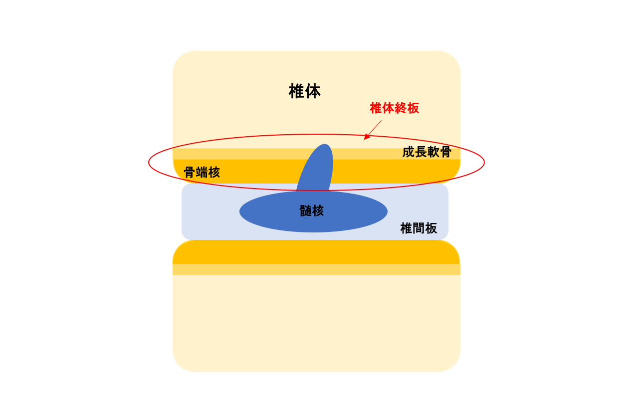 危険な子供の腰痛 腰椎終板障害の予防と治療 江戸川区で整体をお探しなら1回で効果を実感できる葛西にある整骨院鍼灸院ひかりへ