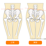 骨盤のゆがみを解消！股関節ストレッチの詳細へ