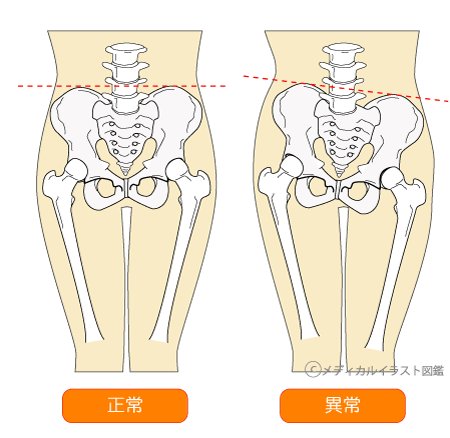 骨盤