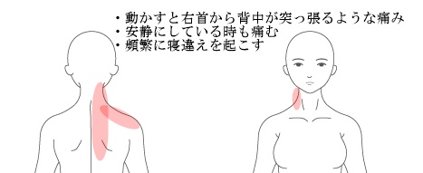 首痛 寝違えの治療例 江戸川区で整体をお探しなら改善率97 4 の葛西にある整骨院鍼灸院ひかりへ