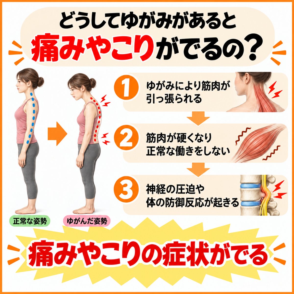 ゆがみが痛みやこりを引き起こす3つの仕組み